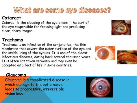 Ppt The Eye Powerpoint Presentation Free Download Id2160688