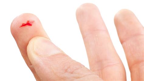 Why Paper Cuts Hurt So Much Bbc Future