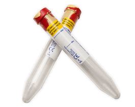 Bd Vacutainer Bd Vacutainer Urinalysis Tube Conical Bottom The Best Hot Sex Picture