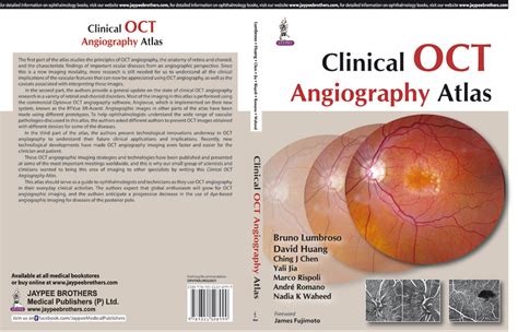 Oct Angiography