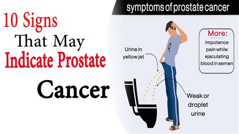 These signs and symptoms are not necessarily caused by prostate cancer, but they should serve as a warning to look for professional medical advice and perform the appropriate tests to rule out this fearsome disease. Prostate cancer signs | 10 Signs That May Indicate ...