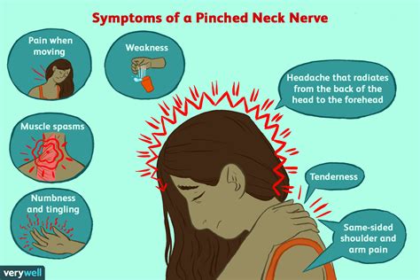 Getting A Headache From A Pinched Nerve