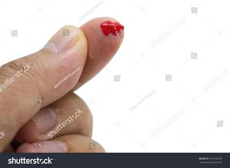 Injured Finger Bleeding White Background Stock Photo 647322535