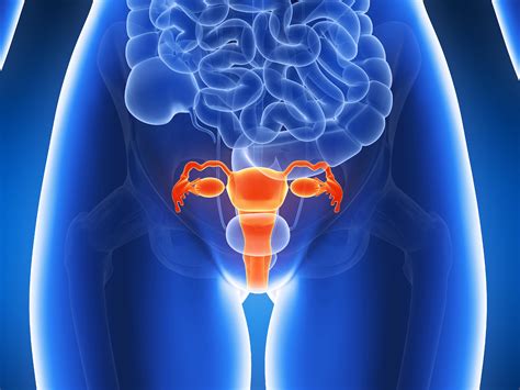 Uterine Cancer Endometrial Cancer Hysterectomy Medlineplus