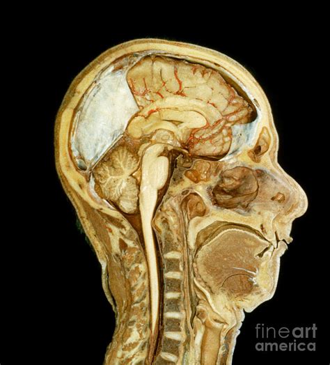 Head And Neck Mid Sagittal Section Photograph By Videosurgery