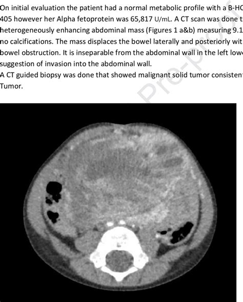A Ct Scan Axial Cut Showing The Tumor Prior To Initiating Treatment