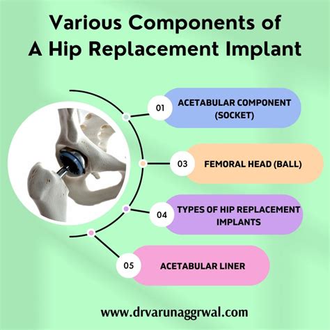 Total Hip Replacement How To Choose The Right Implant Dr Varun Aggarwal