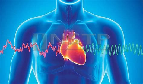 Persatuan jantung amerika menyatakan bahawa tachycardia sinus boleh timbul dari beberapa keadaan yang berbeza, termasuk penyelesaian jangka pendekbagaimana untuk menurunkan kadar degupan jantung anda pada masa ini. Masalah jantung wanita | Harian Metro