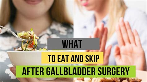 What To Eat And Skip After Gallbladder Surgery Gallbladder Surgery