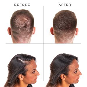 Free delivery and returns on ebay plus items for plus members. Nanogen Keratin Thickening Hair Fibres, 30 g, Black ...