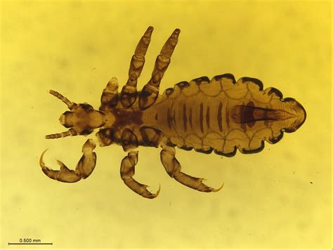 Of Lice And Man Researchers Sequence Human Body Louse Genome