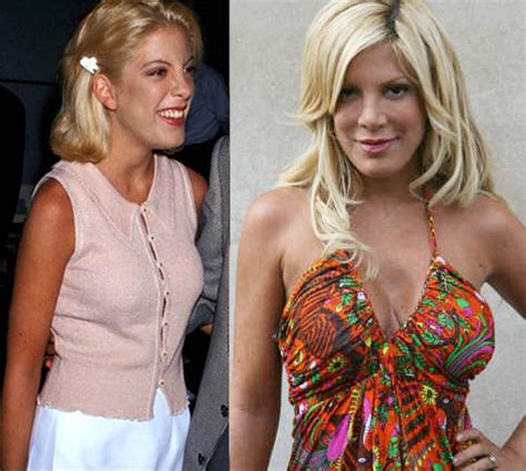 Pin On Tori Spelling Plastic Surgery Hot Sex Picture