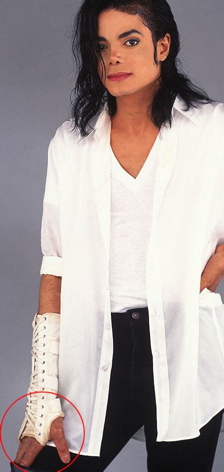 The Vitiligo Proof Michael Jackson Photo 32272052 Fanpop