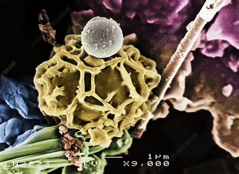 Fungal Spore Sem Stock Image C0489849 Science Photo Library