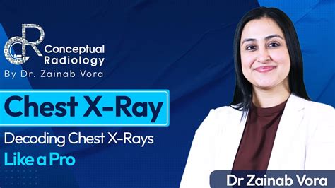 Decoding Chest X Ray Like A Pro With Dr Zainab Vora Conceptual