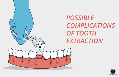 possible complications of tooth extraction elite dental care tracy elite dental care