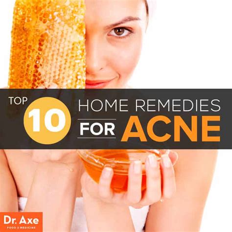 Acne Home Remedies 30 Unique Design Ideas To Create Your Day