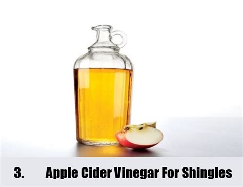 Home Remedies For Shingles Natural Treatments And Cure For Shingles