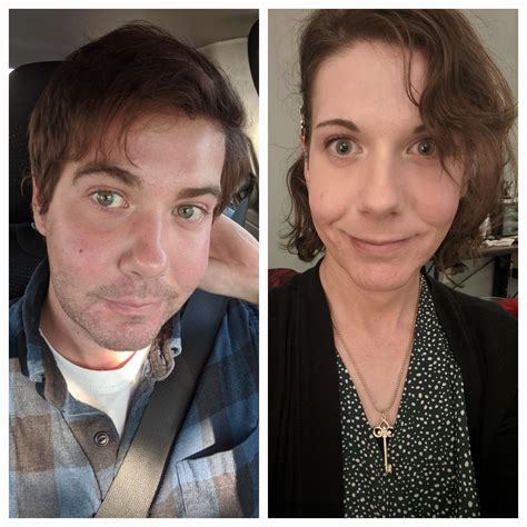 35 Mtf 20 Months Hrt Just A Bit Shy Of A Month Post Op Srs So Happy Rtranstimelines
