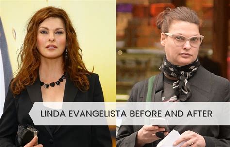 Linda Evangelista Before And After Coolsculpting Check Out Photos