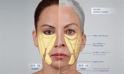 Pin By Stefan On Anatomy For 3d Facial Aesthetics Facial Anatomy