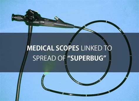 Deadly Superbug Infection Linked To Medical Scopes Bergener Mirejovsky