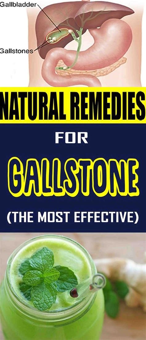 Natural Remedies For Gallstone The Most Effective Natural Remedies
