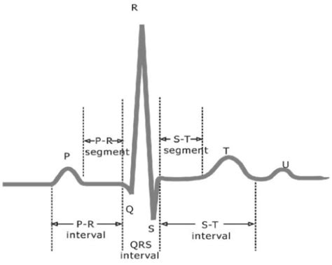 Cardiac Waveform Key To Efficient Heart Rate Monitoring Ee Times