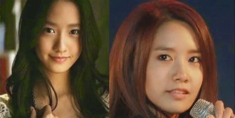 Yoona Snsd Plastic Surgery Nose Job Before And After Pictures