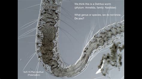 Detritus Worm Under The Microscope Tiny White Worms In The Aquarium