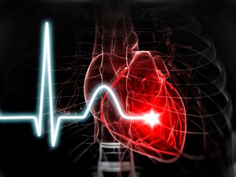 More Intense Blood Pressure Control May Lower Irregular Heartbeat Risk