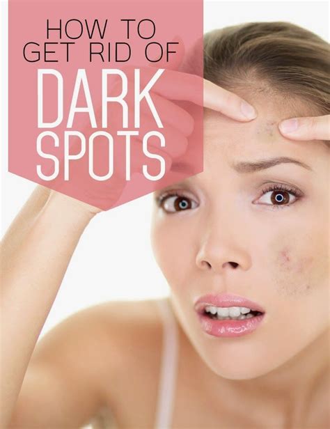How To Get Rid Of Dark Spots How To Get Rid Beauty Solution Dark Spots