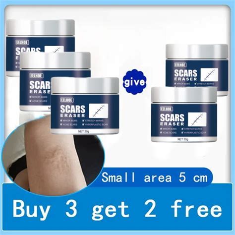 New Rapid Scar Removal Cream Effective Treatment Stretch Marks Burns