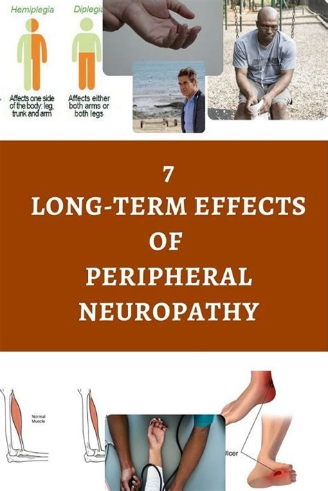 The most common type of neuropathy is peripheral neuropathy. Pin on Bathing