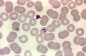 Imagen gratis microfotografía Plasmodium malariae macrogametocito