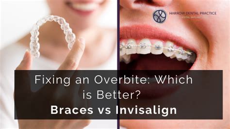 The bottom jaw and teeth are severely overlapped by the upper jaw and teeth. Fixing an Overbite: Which is Better? Braces vs Invisalign ...
