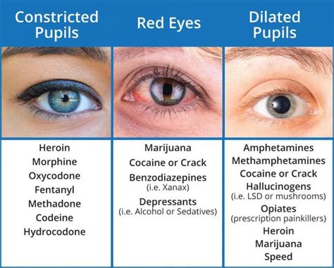 Image Result For Pupil Size Chart Drugs Pharm Pinterest Chart