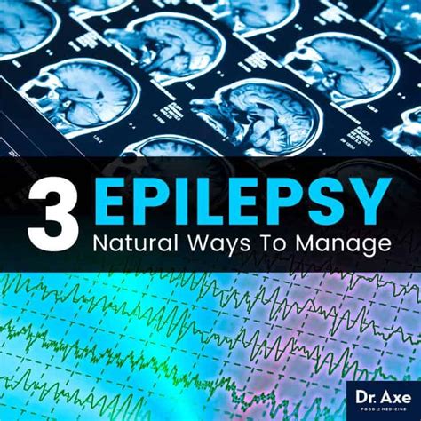 8 Signs A Seizure Is Loooming Epilepsy Symptoms Epilepsy Facts Epilepsy