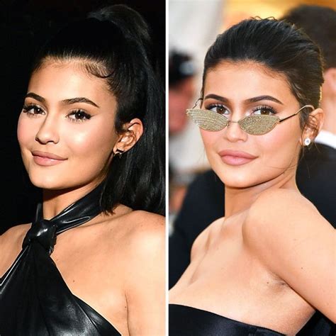 the secret to kylie jenner s lip filler removal kylie jenner lip fillers kylie jenner lip