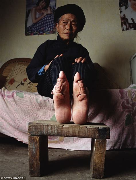 Chinese Woman Recalls Having Her Feet Broken Because Women With Big Feet Were Laughed At Daily