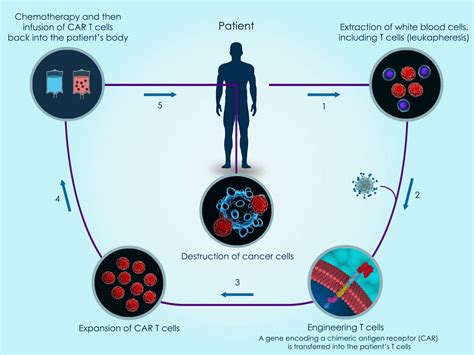 Car T Cell Therapy Diagram