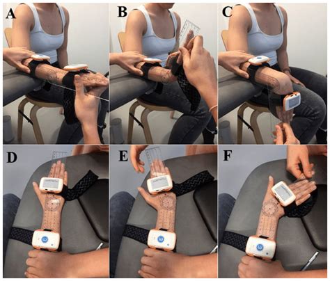 Validity And Reliability Of Inertial Sensors For Elbow And Wrist Range