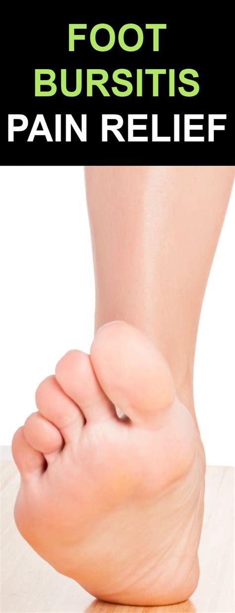 Pin On Foot Bursitis