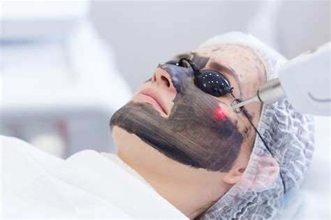 Hollywood Spectra Laser Treatments