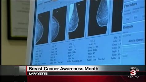 Yearly Mammograms Are Key To Early Detection