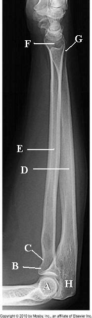Lateral Forearm Radiograph Anatomy Diagram Quizlet