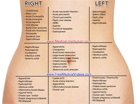 Abdominal Pain Differential Diagnosis Based On Location