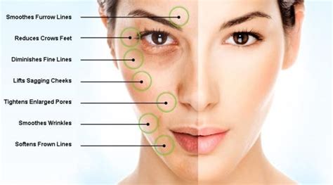 Mesotherapy Linia Skin Clinic