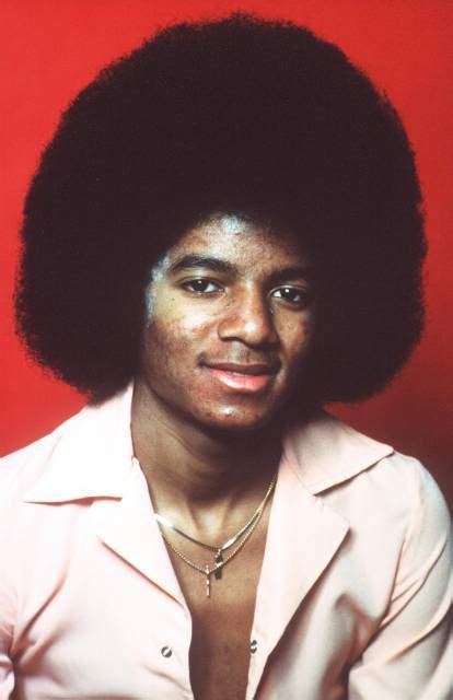 The Vitiligo Proof Michael Jackson Photo 32272051 Fanpop
