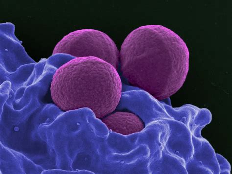New Immunobiotic Could Treat Antibiotic Resistant Superbugs Smart